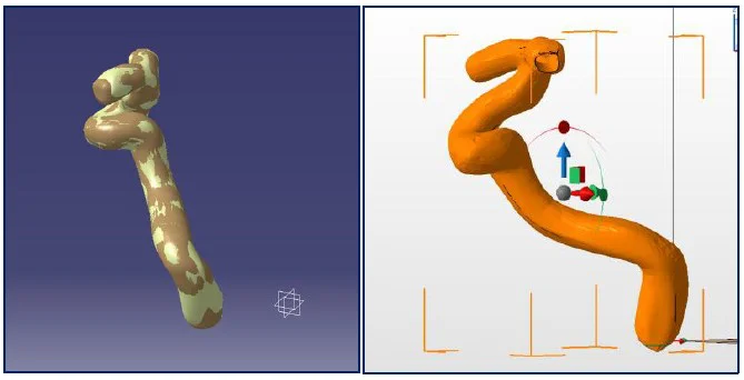 Carotid Reconstruction CAD